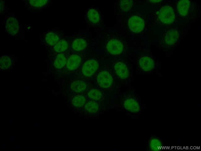 NAB2 Antibody in Immunocytochemistry (ICC/IF)