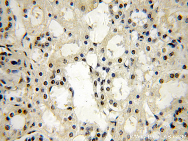 NAB2 Antibody in Immunohistochemistry (Paraffin) (IHC (P))