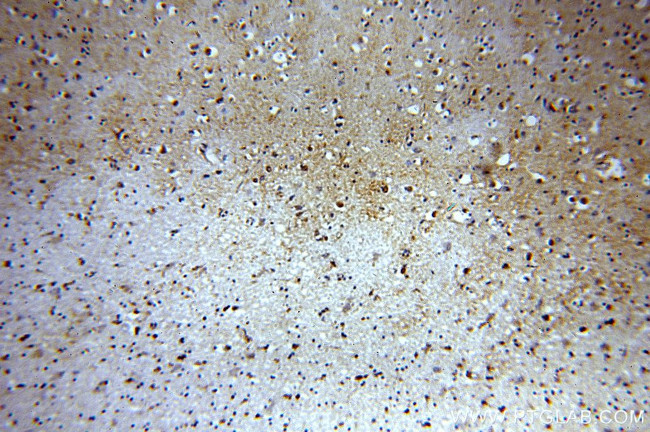 NAB2 Antibody in Immunohistochemistry (Paraffin) (IHC (P))