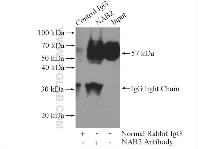 NAB2 Antibody in Immunoprecipitation (IP)