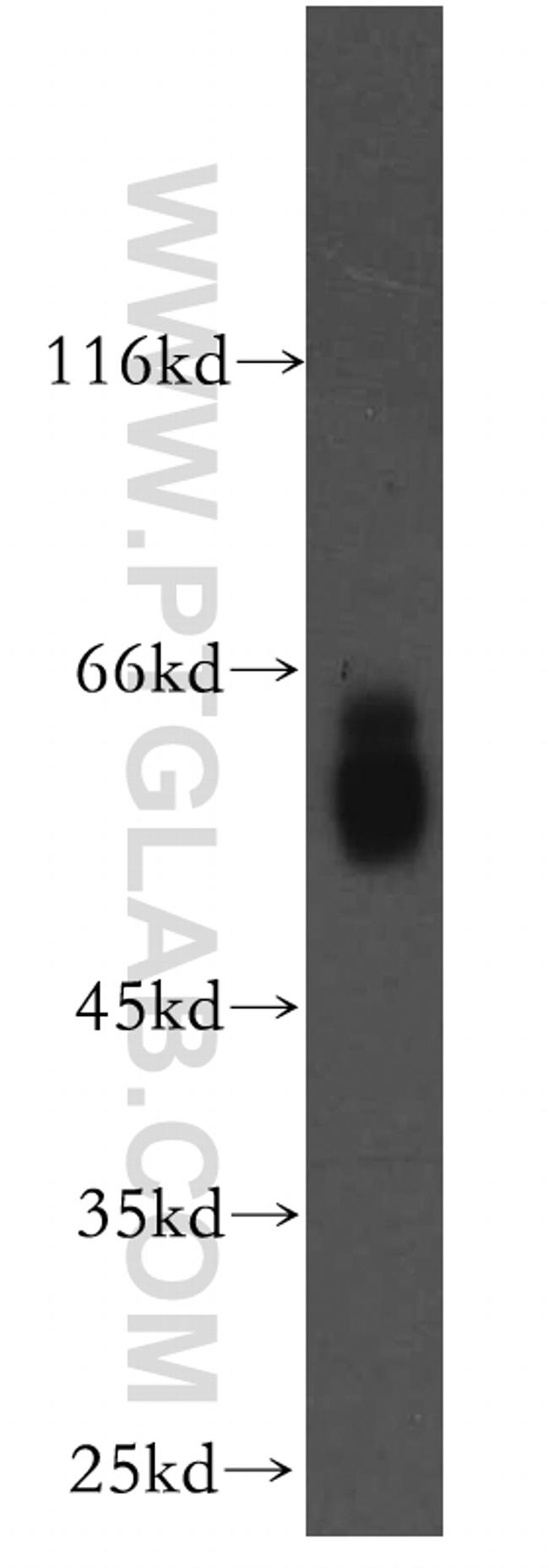 NAB2 Antibody in Western Blot (WB)