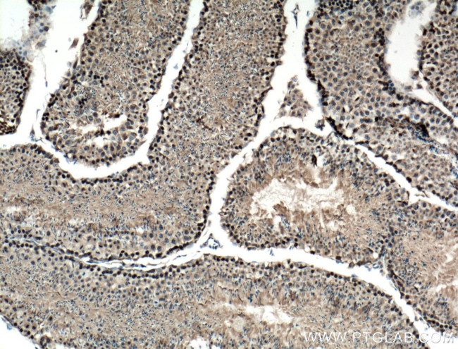 TRIP13 Antibody in Immunohistochemistry (Paraffin) (IHC (P))