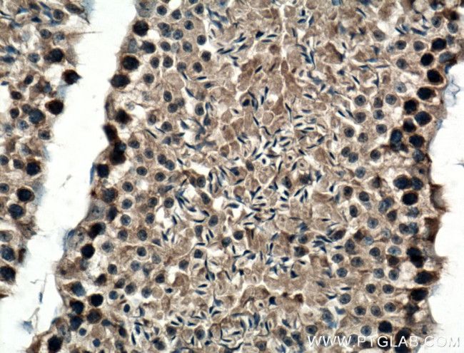 TRIP13 Antibody in Immunohistochemistry (Paraffin) (IHC (P))