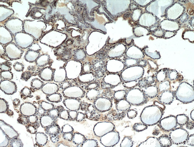 TRIP13 Antibody in Immunohistochemistry (Paraffin) (IHC (P))