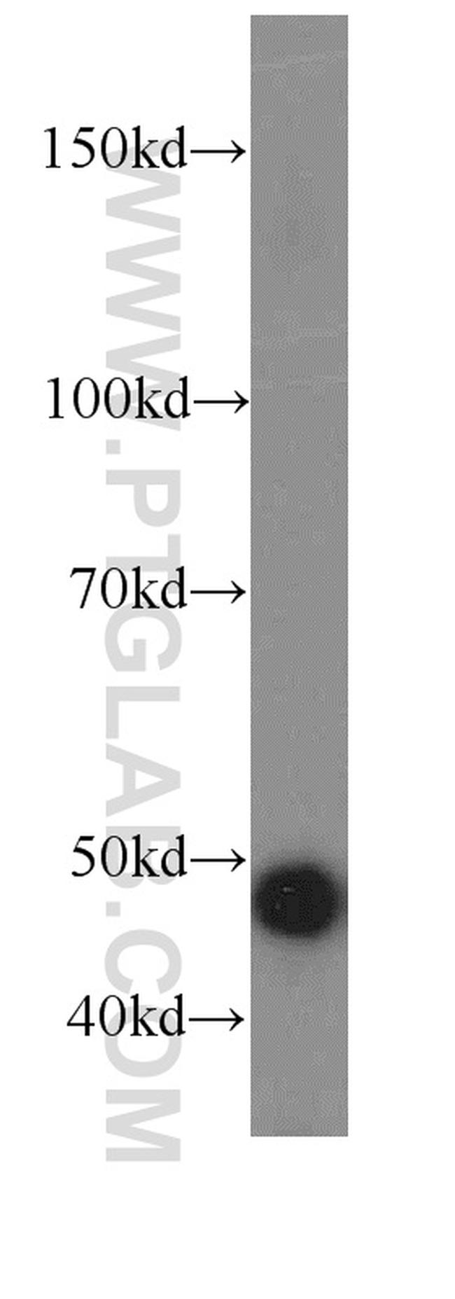 TRIP13 Antibody in Western Blot (WB)