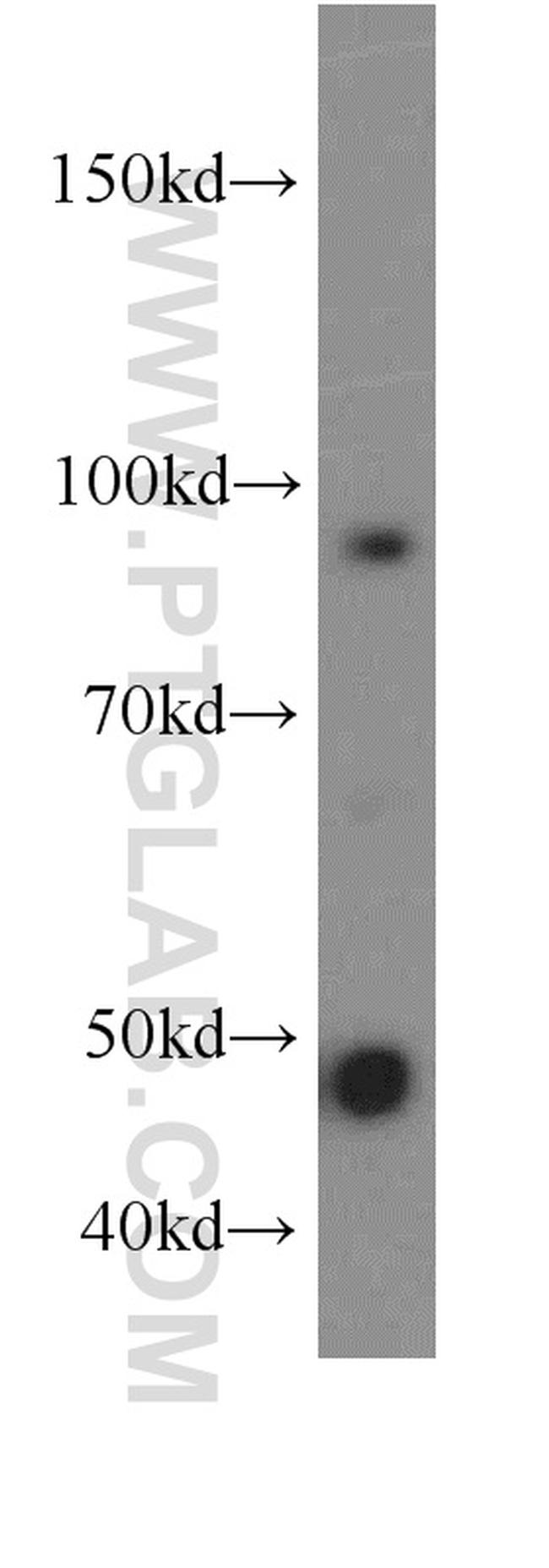 TRIP13 Antibody in Western Blot (WB)