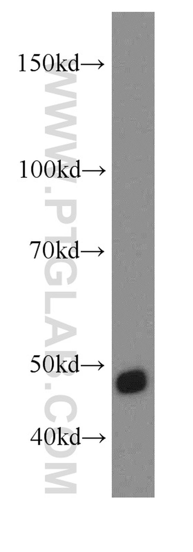 TRIP13 Antibody in Western Blot (WB)