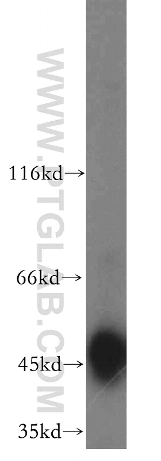 TRIP13 Antibody in Western Blot (WB)