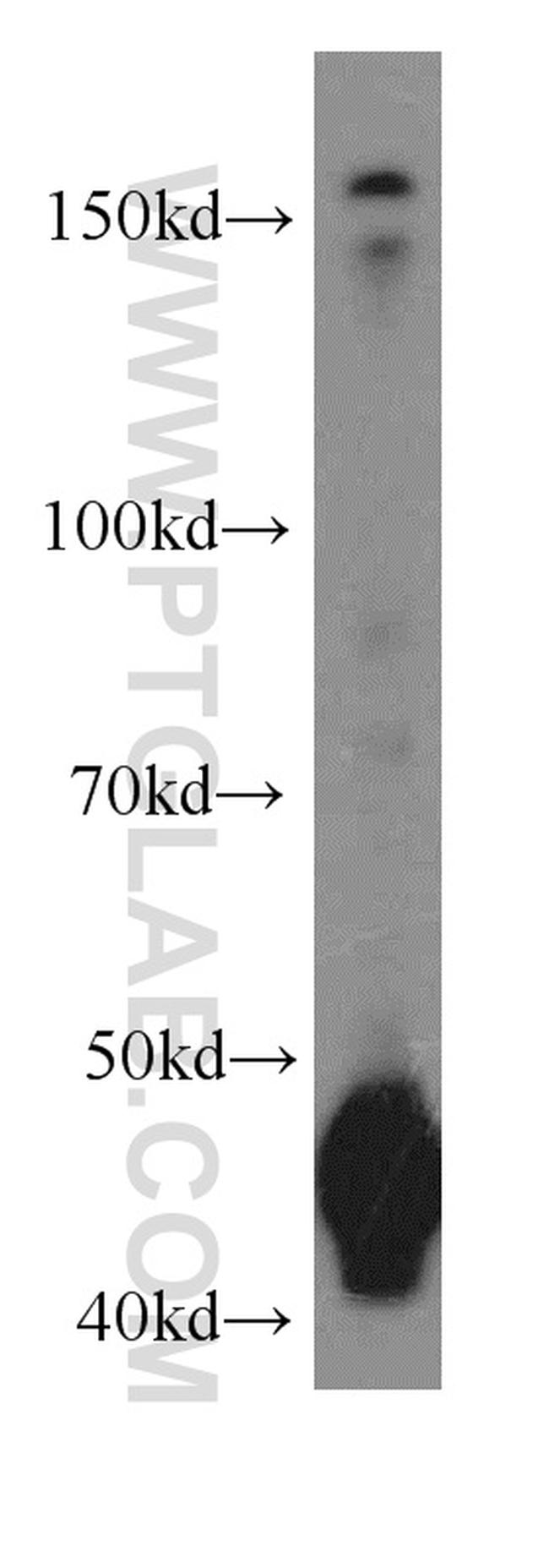 TRIP13 Antibody in Western Blot (WB)