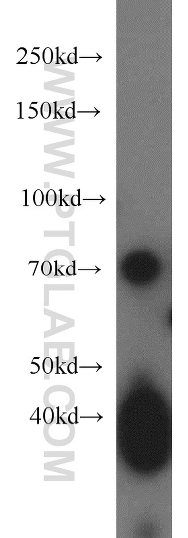 PCDHB5 Antibody in Western Blot (WB)