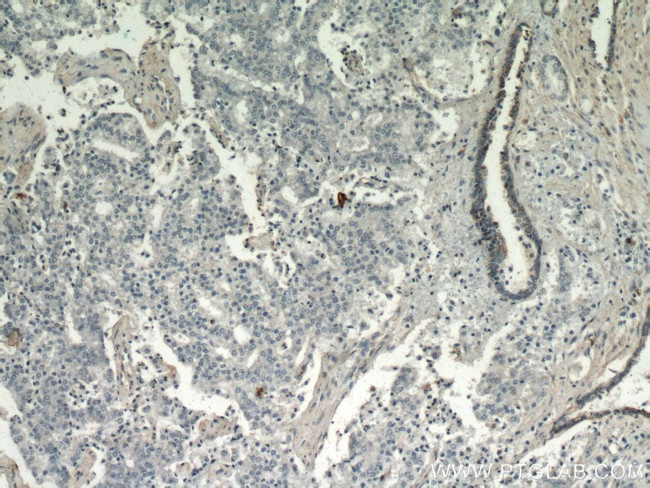 HYAL3 Antibody in Immunohistochemistry (Paraffin) (IHC (P))