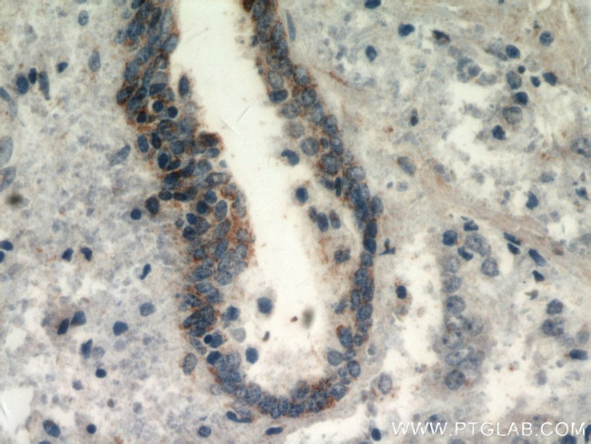 HYAL3 Antibody in Immunohistochemistry (Paraffin) (IHC (P))