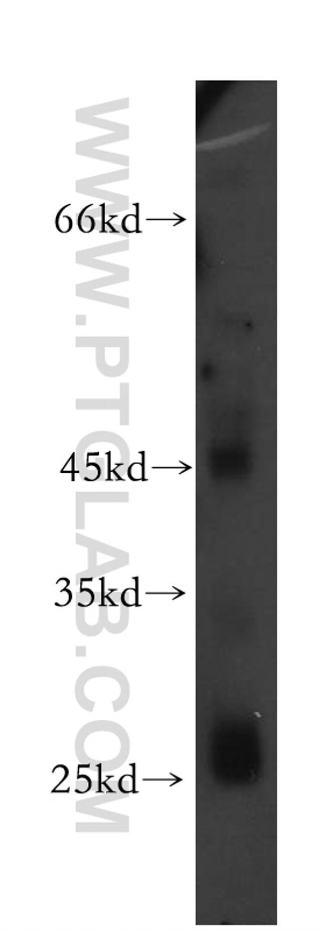 HYAL3 Antibody in Western Blot (WB)