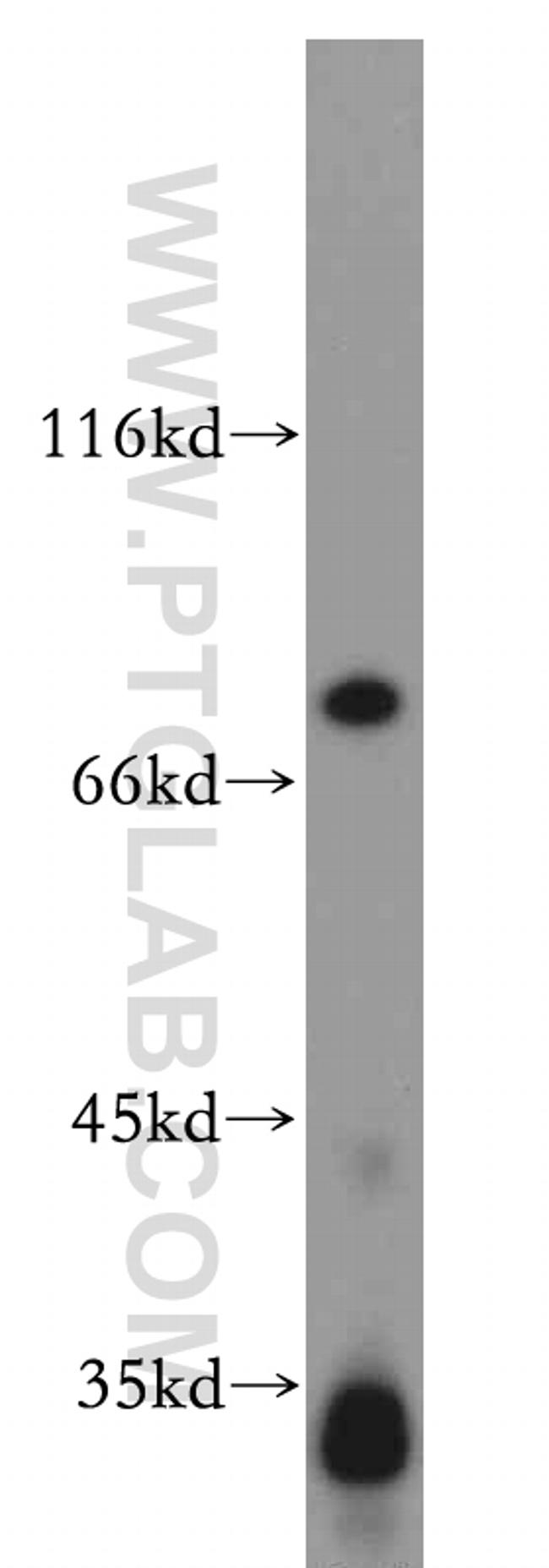 Histone H1.2 Antibody in Western Blot (WB)