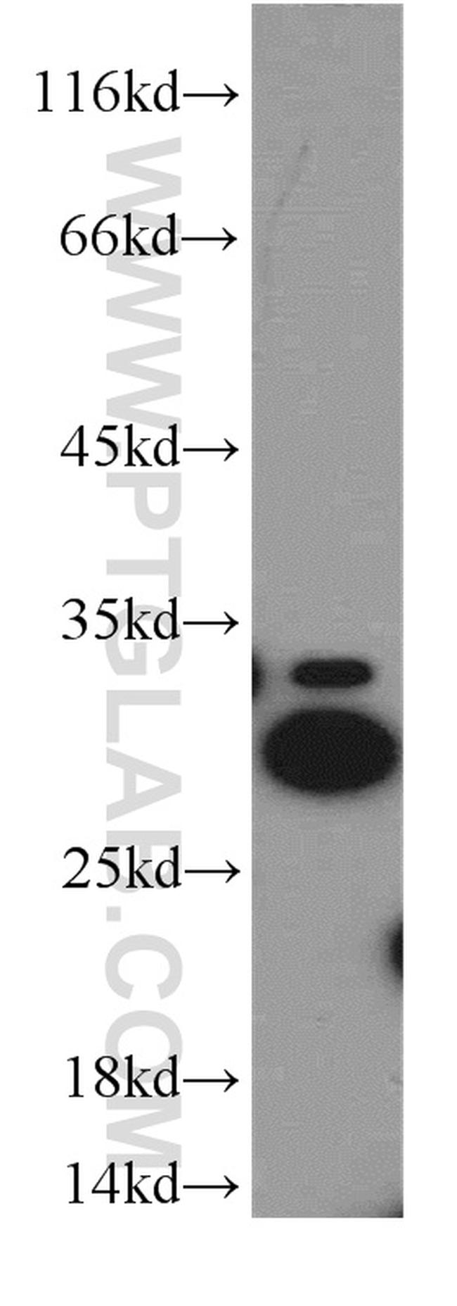 Histone H1.2 Antibody in Western Blot (WB)