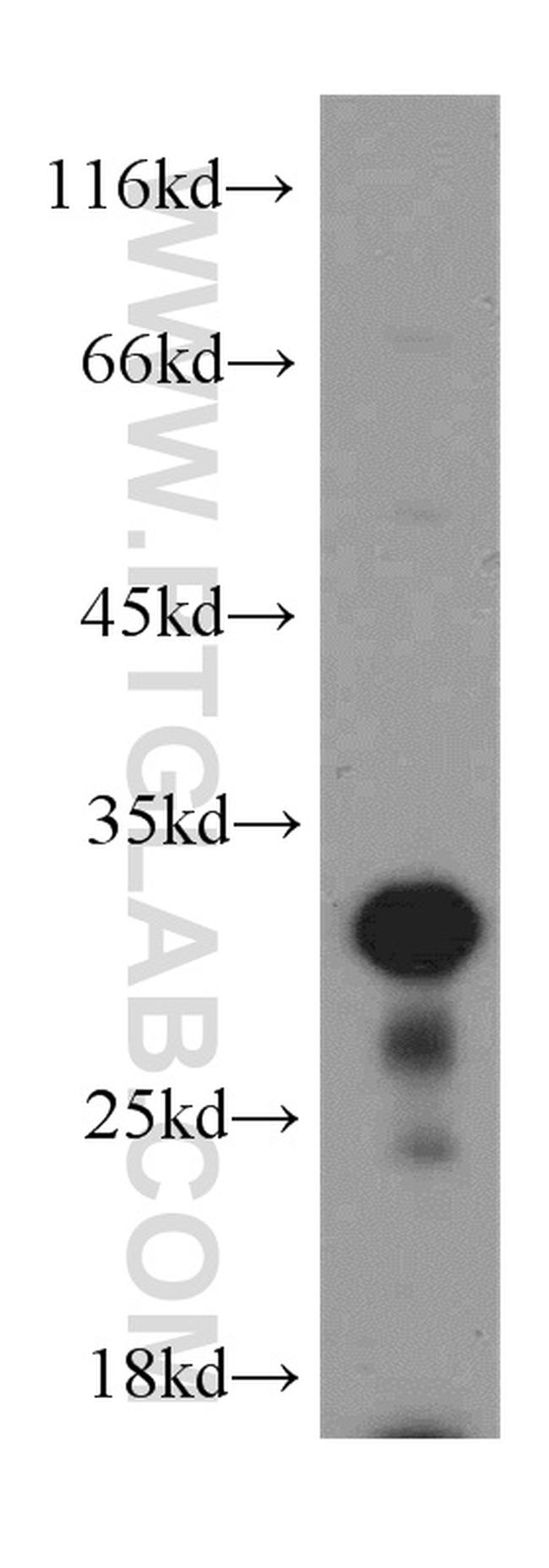 Histone H1.2 Antibody in Western Blot (WB)