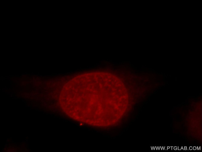 Histone H1.2 Antibody in Immunocytochemistry (ICC/IF)