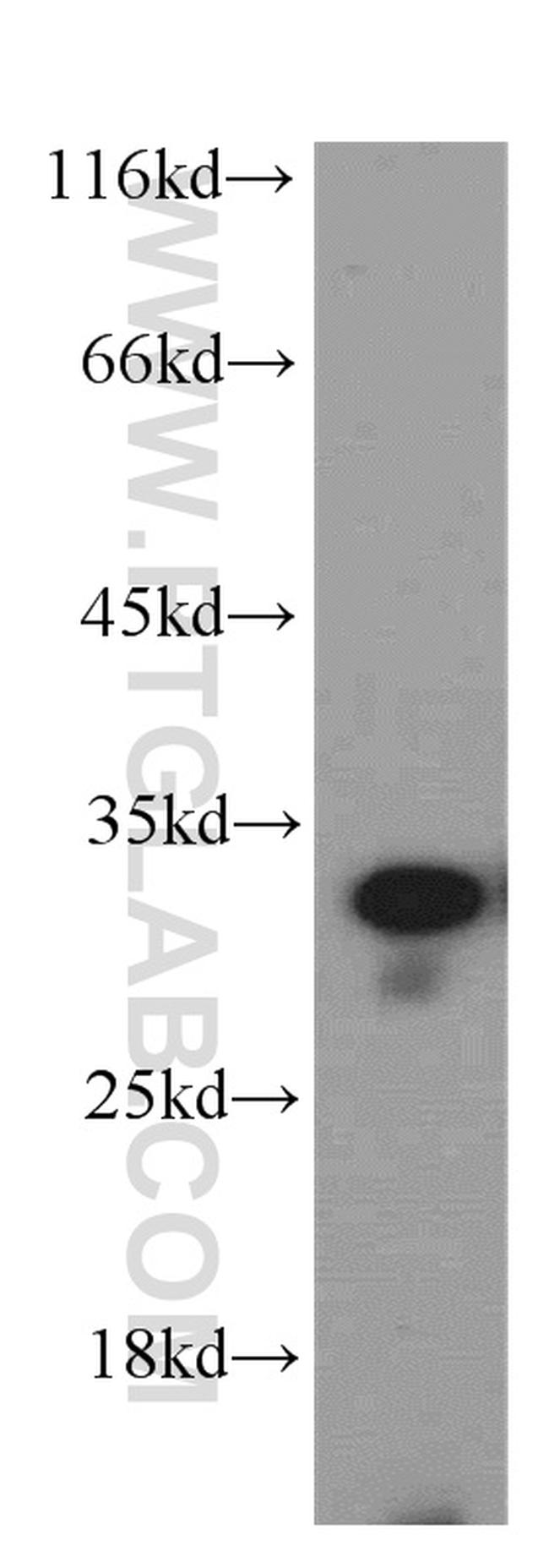 Histone H1.2 Antibody in Western Blot (WB)