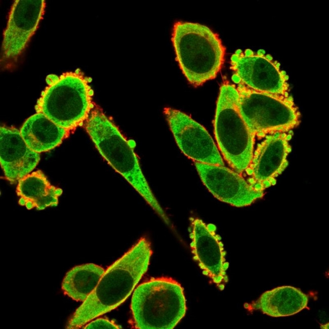 EIF2S1/EIF-2 alpha (EIF2A) Antibody in Immunocytochemistry (ICC/IF)