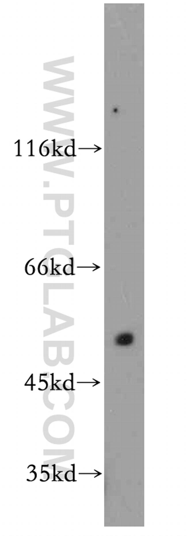 MUTYH Antibody in Western Blot (WB)