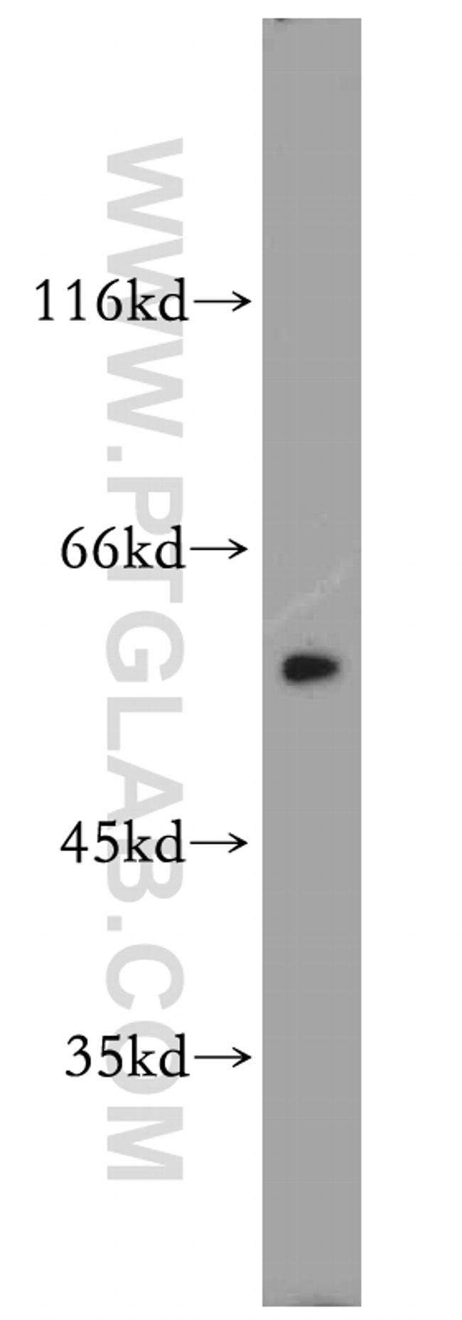 MUTYH Antibody in Western Blot (WB)