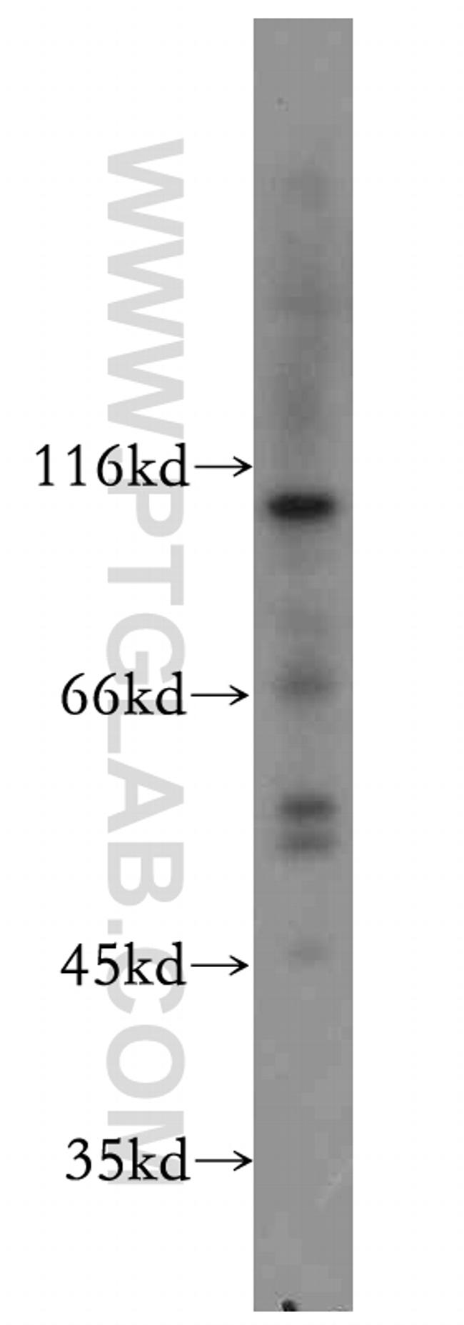 MUTYH Antibody in Western Blot (WB)