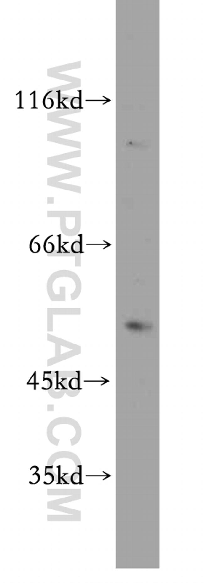 MUTYH Antibody in Western Blot (WB)