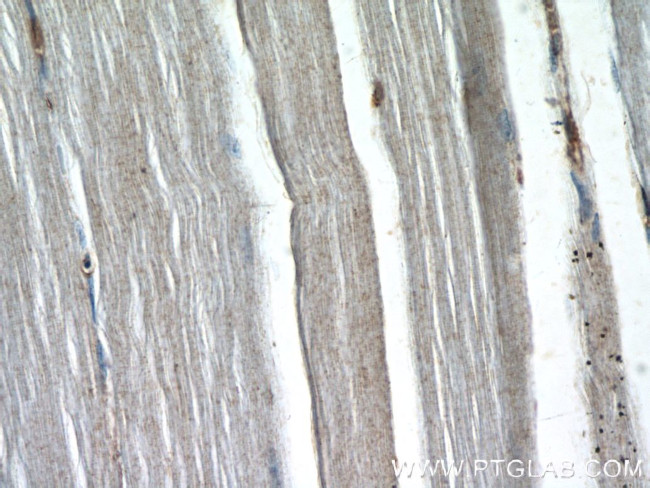 SIRT2 Antibody in Immunohistochemistry (Paraffin) (IHC (P))