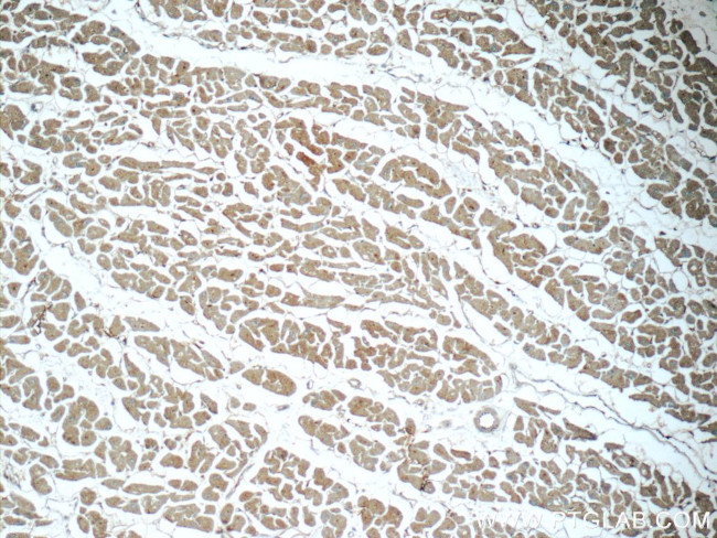 SIRT2 Antibody in Immunohistochemistry (Paraffin) (IHC (P))