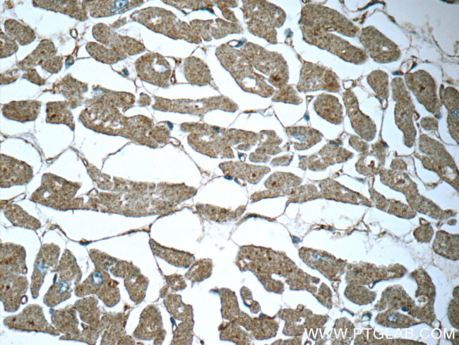 SIRT2 Antibody in Immunohistochemistry (Paraffin) (IHC (P))