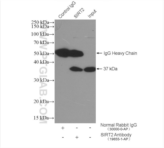 SIRT2 Antibody in Immunoprecipitation (IP)