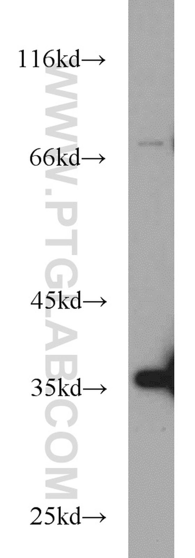 SIRT2 Antibody in Western Blot (WB)