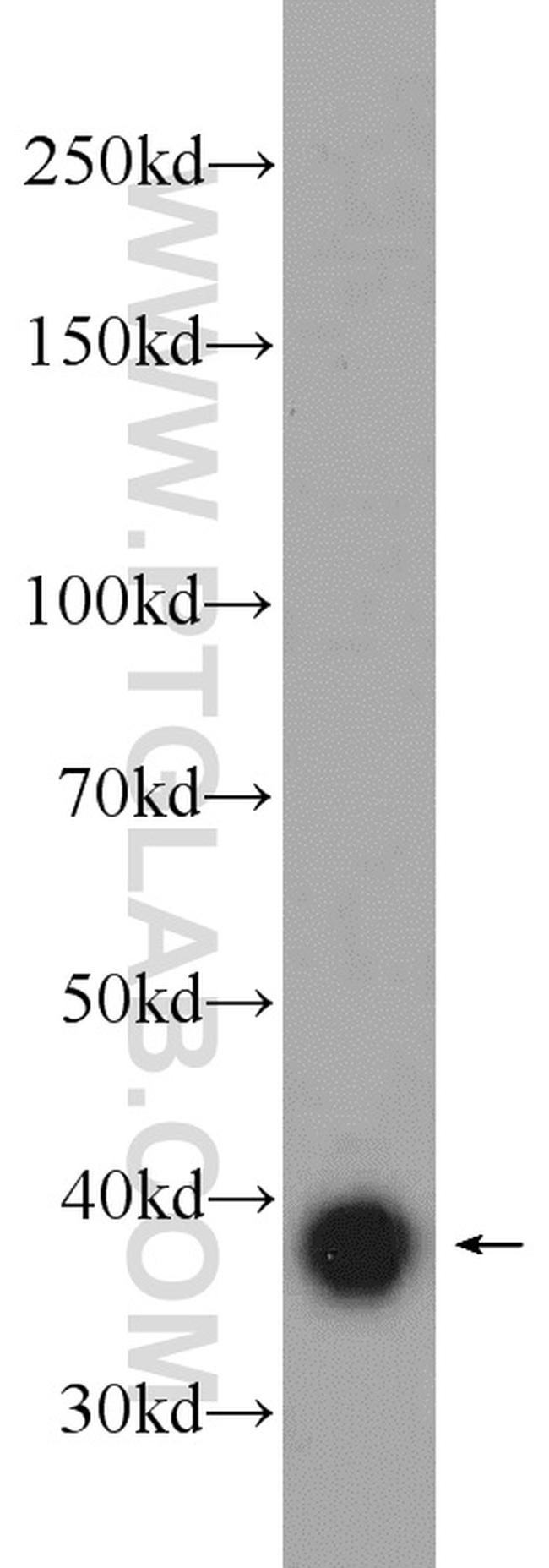 SIRT2 Antibody in Western Blot (WB)