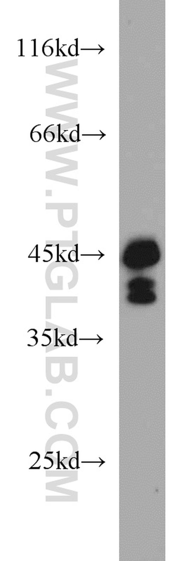 SIRT2 Antibody in Western Blot (WB)