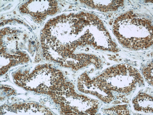 Hexokinase 1 Antibody in Immunohistochemistry (Paraffin) (IHC (P))