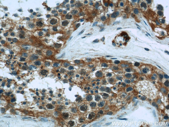 Hexokinase 1 Antibody in Immunohistochemistry (Paraffin) (IHC (P))