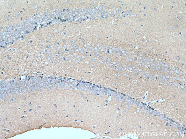 Hexokinase 1 Antibody in Immunohistochemistry (Paraffin) (IHC (P))