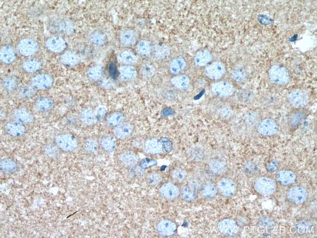 Hexokinase 1 Antibody in Immunohistochemistry (Paraffin) (IHC (P))