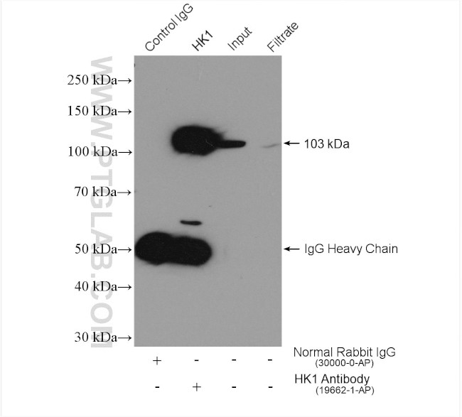 Hexokinase 1 Antibody in Immunoprecipitation (IP)