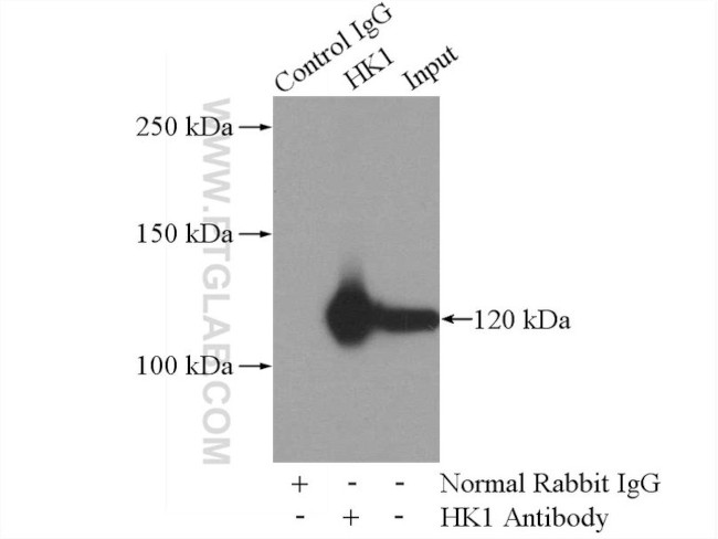 Hexokinase 1 Antibody in Immunoprecipitation (IP)