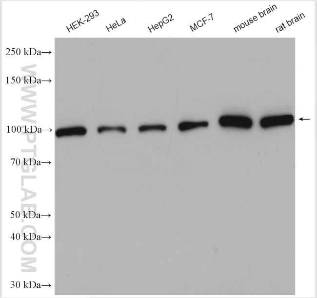 Hexokinase 1 Antibody in Western Blot (WB)