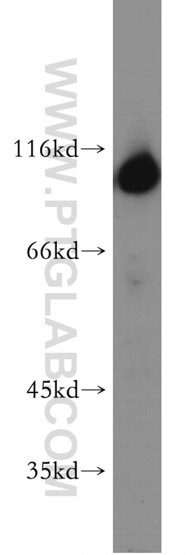 Hexokinase 1 Antibody in Western Blot (WB)