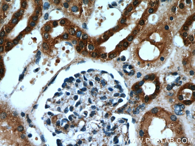 Hexokinase 1 Antibody in Immunohistochemistry (Paraffin) (IHC (P))