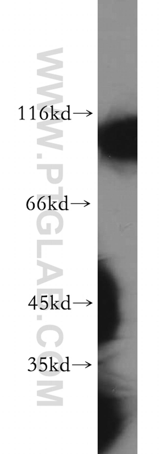 Hexokinase 1 Antibody in Western Blot (WB)