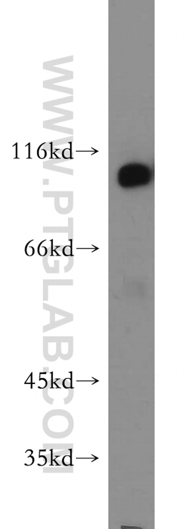 Hexokinase 1 Antibody in Western Blot (WB)