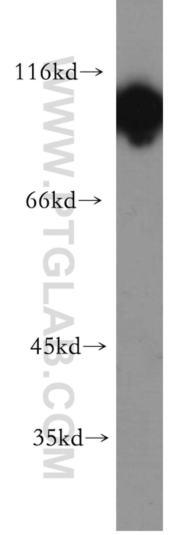 Hexokinase 1 Antibody in Western Blot (WB)