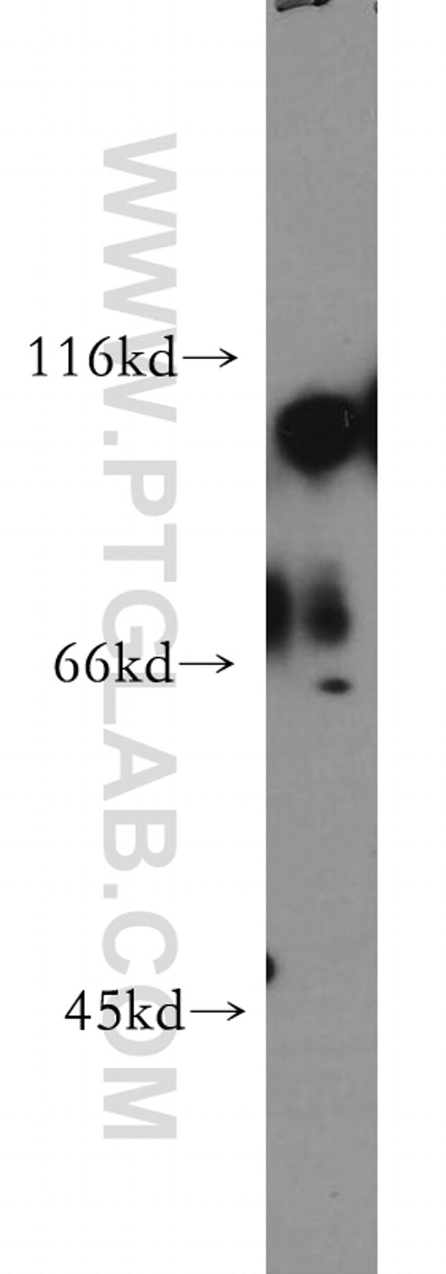 Hexokinase 1 Antibody in Western Blot (WB)