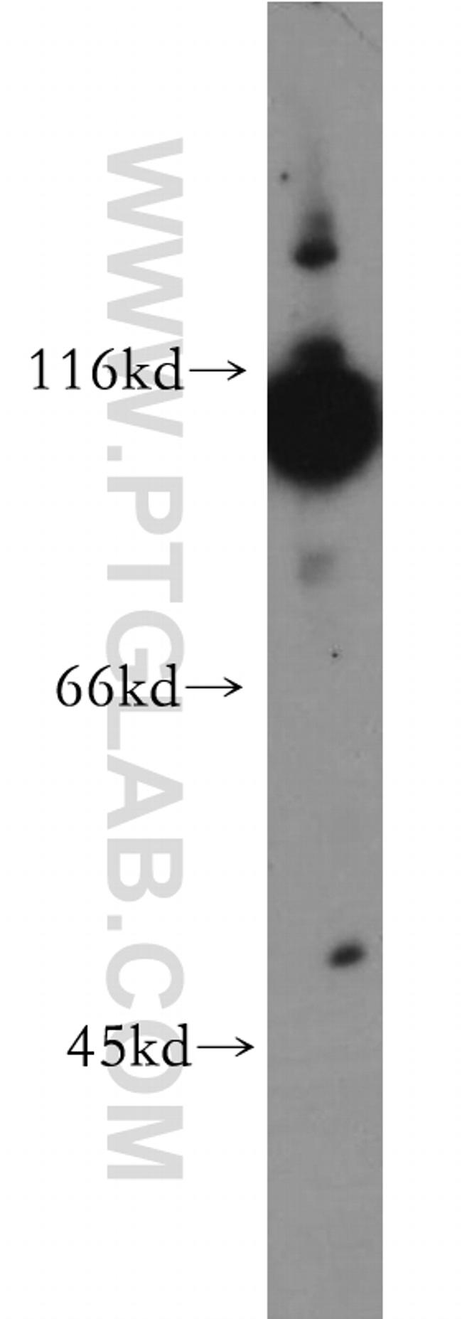 Hexokinase 1 Antibody in Western Blot (WB)