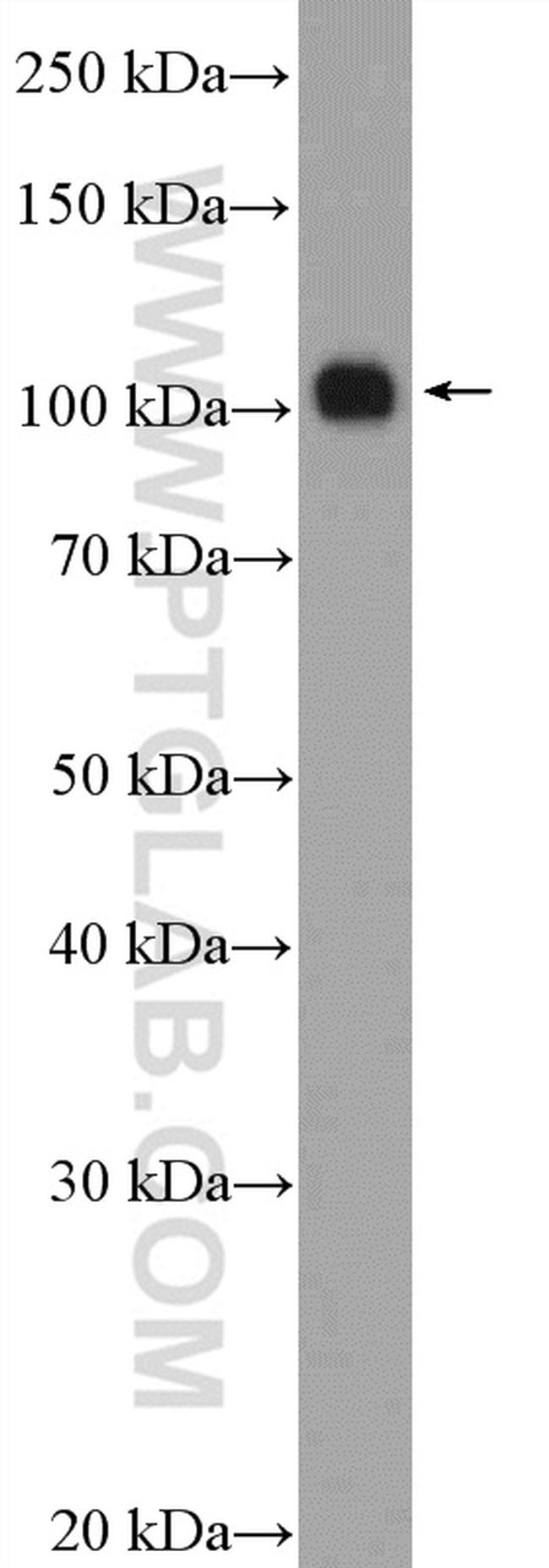 Hexokinase 1 Antibody in Western Blot (WB)