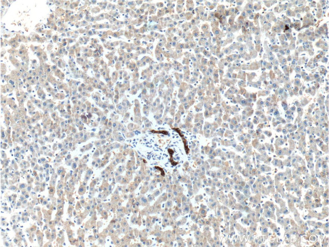 GCK Antibody in Immunohistochemistry (Paraffin) (IHC (P))